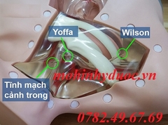 MÔ HÌNH ĐẶT CATHETER TĨNH MẠCH TRUNG TÂM