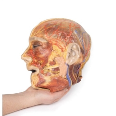 MÔ HÌNH GIẢI PHẪU DÂY THẦN KINH MẶT & TUYẾN MANG TAI ĐƯỢC IN 3D ERLER ZIMMER