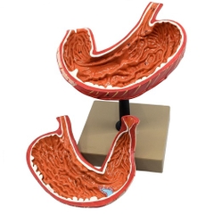 MÔ HÌNH GIẢI PHẪU DẠ DÀY 2 PHẦN 3D