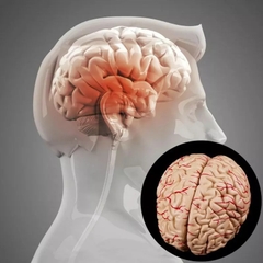 MÔ HÌNH GIẢI PHẪU NÃO NGƯỜI