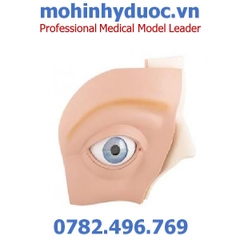 MÔ HÌNH MẮT VỚI CÁC BỆNH GIÁC MẠC – 1001264 – 3B SCIENTIFIC