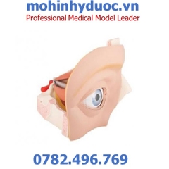 MÔ HÌNH MẮT VỚI CÁC BỆNH GIÁC MẠC – 1001264 – 3B SCIENTIFIC