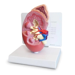 Mô hình thận rời của con người