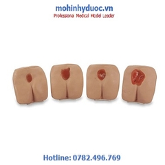 MÔ HÌNH THỰC HÀNH CHĂM SÓC VẾT LOÉT BỐN GIAI ĐOẠN - LF00934