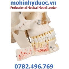 MÔ HÌNH XƯƠNG SỌ MẶT, CÁC LỖ CỦA DÂY THẦN KINH – 1000059 – 3B SCIENTIFIC