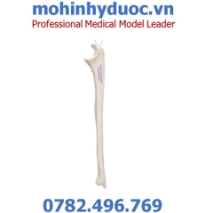 MÔ HÌNH XƯƠNG TRỤ – 1019373 – 3B SCIENTIFIC