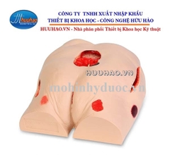 MÔ HÌNH THỰC HÀNH CHĂM SÓC VẾT LOÉT VÙNG MÔNG – NASCO