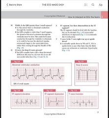 Sách ngoại văn The ECG Made Easy 9th