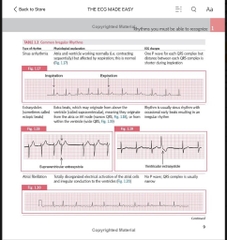 Sách ngoại văn The ECG Made Easy 9th