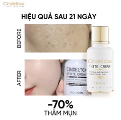 (HĐ) Kem Dưỡng Trắng Da Incugen Cindel Tox White Cream Premium mẫu mới