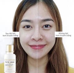 (HĐ) Kem Dưỡng Trắng Da Incugen Cindel Tox White Cream Premium mẫu mới