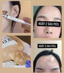 Thay da sinh học BQcell Derma skin peeling (60ea)