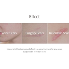Kem trị sẹo Noscarna  dạng gel 20g (200ea)