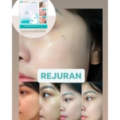 Mặt nạ cấp ẩm chống lão hoá REJURAN Hộp 5 miếng (72ea)