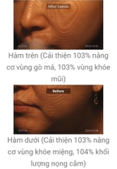 Kem nâng cơ cổ DCA Medilab daycell 50ml (80ea)