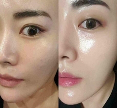 Tinh chất vàng 24k GOLD VITA AMPOULE