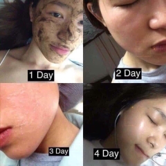 Thay da sinh học BQcell Derma skin peeling (60ea)