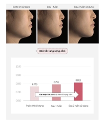 Kem nâng cơ cổ DCA Medilab daycell 50ml (80ea)