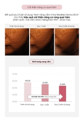 Kem nâng cơ cổ DCA Medilab daycell 50ml (80ea)