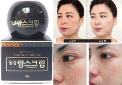 Kem trị nám Dongsung mini 10gam (200ea)