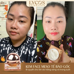 [MUA 1 ĐƯỢC 3] Kem Face Meso Tế Bào Gốc Pure Geneso Advanced Cream Lycos 20g: Sáng mịn, bật tone