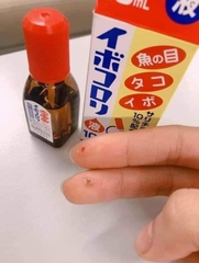 Trị Mụn Cơm Mụn Cóc Ibokorori 10Ml