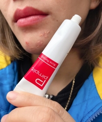 Trị Mụn Pimplit Shiseido 18G