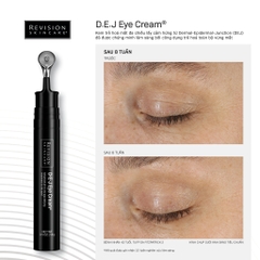 Kem Dưỡng Ẩm Xóa Nhăn và Làm Săn Chắc Vùng Mắt Revision D·E·J Eye Cream®