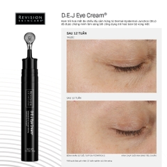 Kem Dưỡng Ẩm Xóa Nhăn và Làm Săn Chắc Vùng Mắt Revision D·E·J Eye Cream®