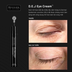 Kem Dưỡng Ẩm Xóa Nhăn và Làm Săn Chắc Vùng Mắt Revision D·E·J Eye Cream®