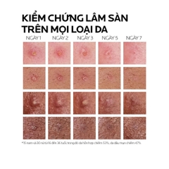 Kem Dưỡng Giảm Mụn Nhanh 8 Giờ & Ngừa Mụn Tái Phát La Roche-Posay Effaclar Duo+ M