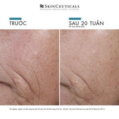 SkinCeuticals C E Ferulic® - Tinh Chất Chống Oxy Hóa Đột Phá (Vitamin C 15%, E 1%, Ferulic 0.5%)