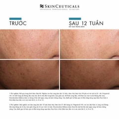 SkinCeuticals Discoloration Defense - Tinh Chất Chuyên Biệt Giảm Đốm Nâu & Thâm Mụn (Tranexamic Acid 3%)