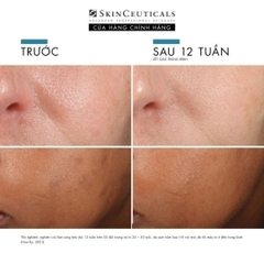 SkinCeuticals Phloretin CF - Tinh Chất Chống Oxy Hóa Bảo Vệ Da & Cải Thiện Sắc Tố (Vitamin C 10%)