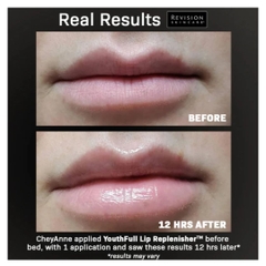 Son Dưỡng Căng Mọng & Mờ Rãnh Nhăn Revision Youthfull Lip Replenisher®