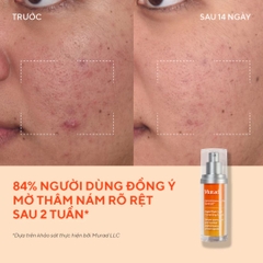 Tinh Chất Giảm Nám & Thâm Sạm Cấp Tốc Murad Rapid Dark Spot Correcting Serum (Công Nghệ Resorcinol Độc Quyền)