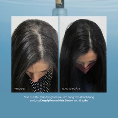Tinh Chất Giảm Rụng Kích Mọc Tóc Hush & Hush DeeplyRooted Hair Serum