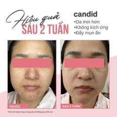 Tinh Chất Trẻ Hóa Da Candid Retinol 0.5