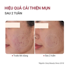 Tinh Chất Trẻ Hóa Da Fusion Retinol 1.0