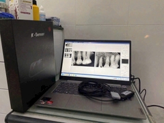 K2 Sensor chính hãng Woodpecker