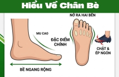Chân Bè Là Gì? Làm Sao Để Biết Mình Có Bàn Chân Bè?