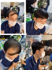 phủ hói nam tóc thật A01