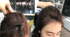 kẹp phồng mái cao 3 kẹp