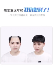 phủ hói nam tóc thật A01