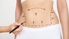 4 cách giảm sưng tấy sau hút mỡ được khuyên bởi các chuyên gia thẩm mỹ