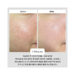 Vi Kim VT Reedle Shot 100 Essence 30ml Tách Set Nobox + Tặng Serum PDRN 1.5ml