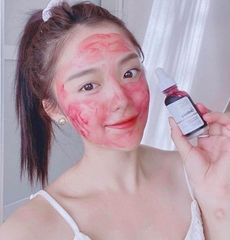 Serum The Ordinary AHA 30% + BHA 2% Peeling Solution Giảm Mụn Sáng Da - 30ml - Fullbox Hàng US