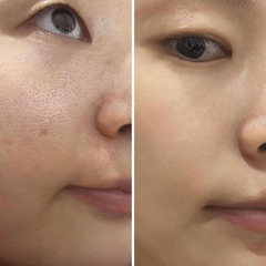 Serum Cà Chua Xanh Sungboon Thu Nhỏ Lỗ Chân Lông Editor Green Tomato Pore Lifting Ampoule+ 30ml (Tách set Nobox)