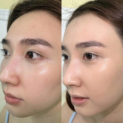 Kem phục hồi Martiderm Cicra-vass 30ml Fullbox Hàng Công Ty