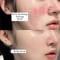 Serum Phục Hồi Cấp Ẩm Medik8 B5 60 ml Nobox